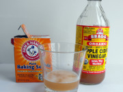 Apple cider vinegar baking soda fibroid treatment